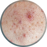 Unfiltered tap water sample