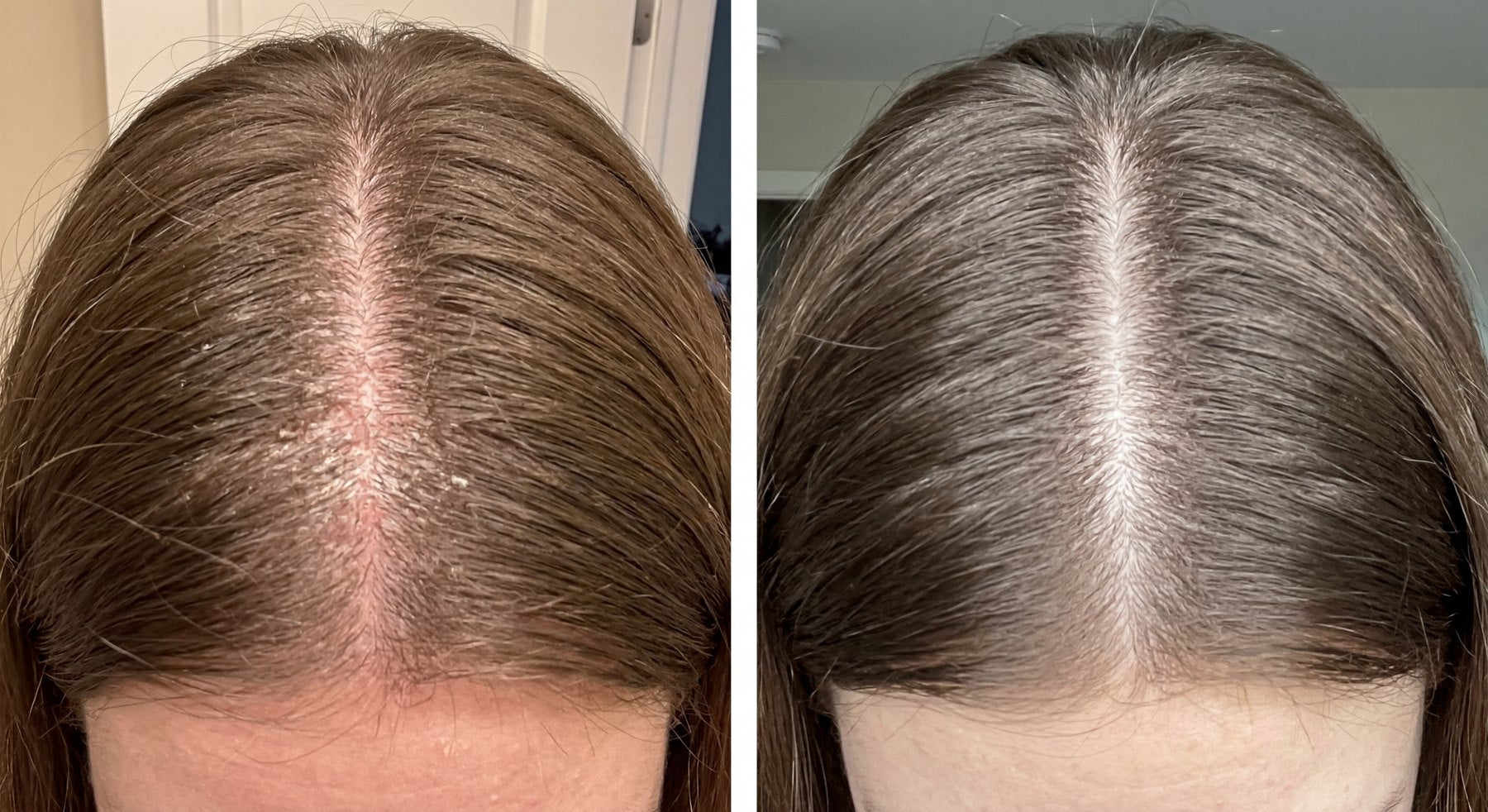 Scalp, before and after