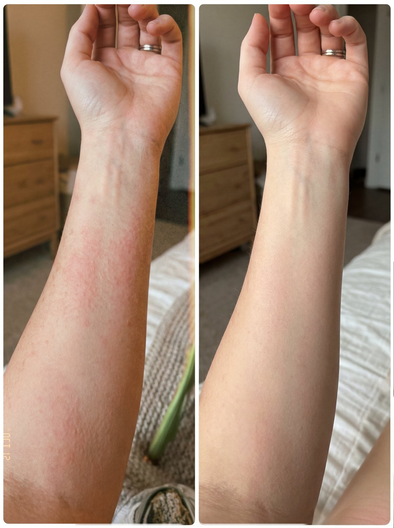 Skin, before and after