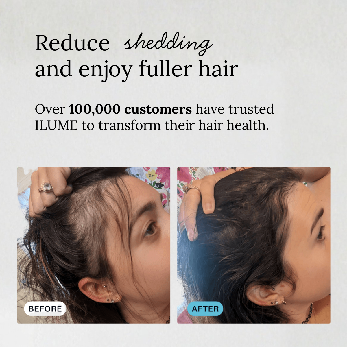 Healthier Hair and Skin in 4 Weeks